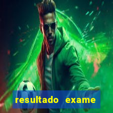 resultado exame eliel figueiredo